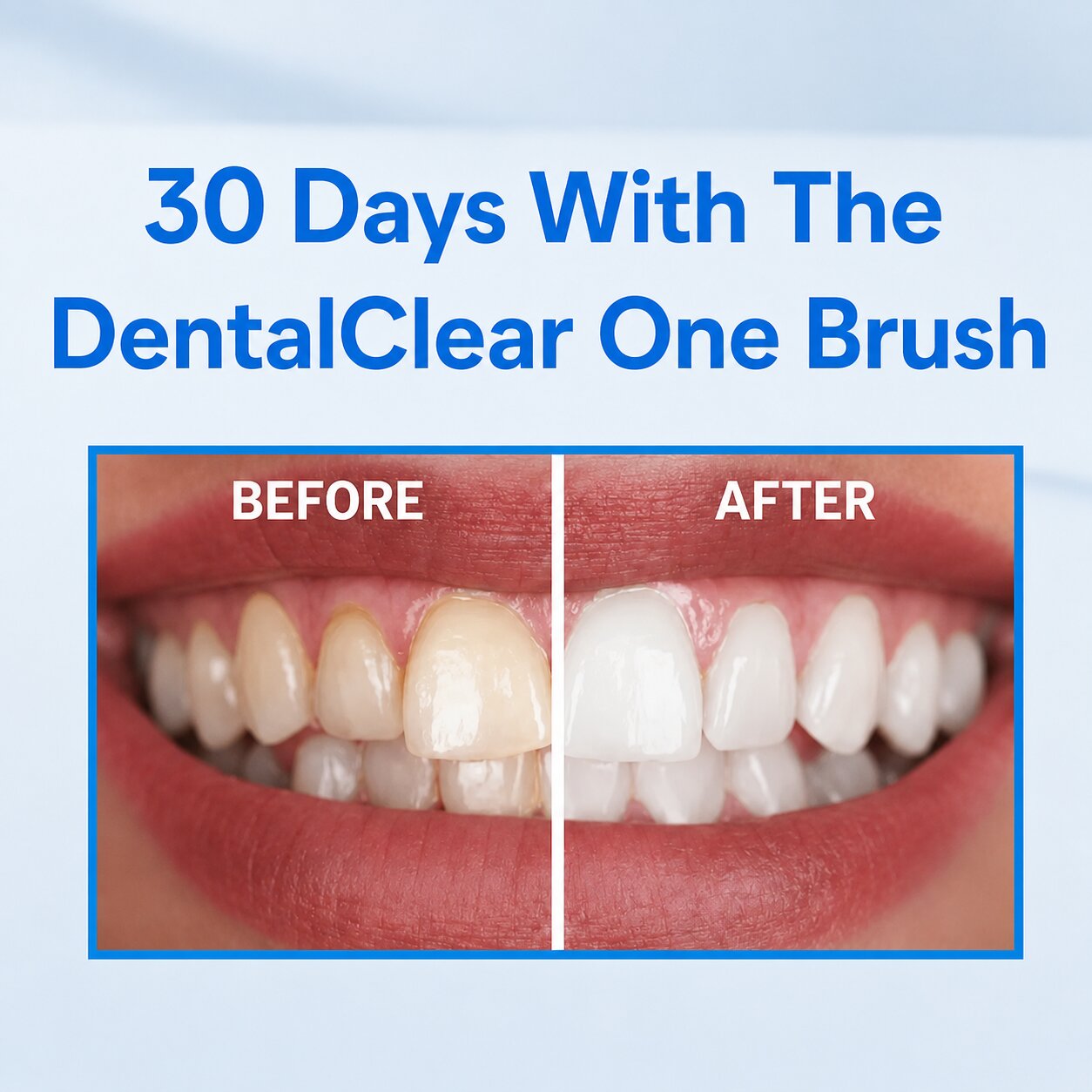 DentalClear One