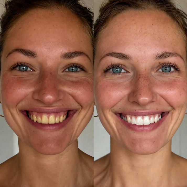DentalClear One