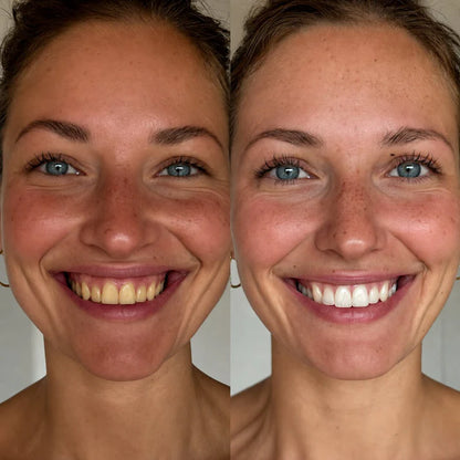 DentalClear One